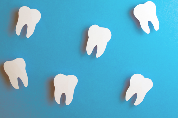 インプラントのメインテナンスイメージ